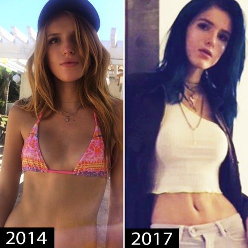 It’s obvious that Bella Thorne’s plastic surgery extended to her breasts. 